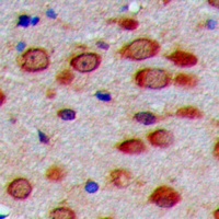 PEX11G Rabbit Polyclonal Antibody