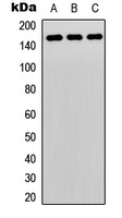 PLC gamma 2 Rabbit Polyclonal Antibody