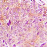 PLC gamma 2 Rabbit Polyclonal Antibody