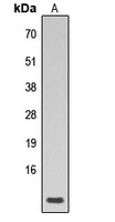 Phospholamban (Phospho-S16/T17) Rabbit Polyclonal Antibody