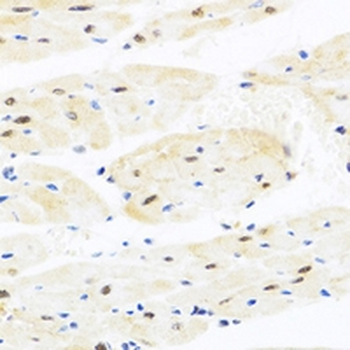 TAF9 Rabbit Polyclonal Antibody