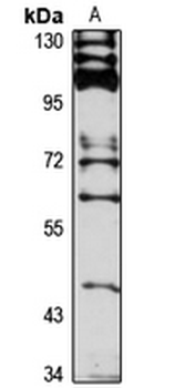 SLC22A15 Rabbit Polyclonal Antibody