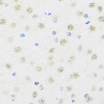 DDX50 Rabbit Polyclonal Antibody