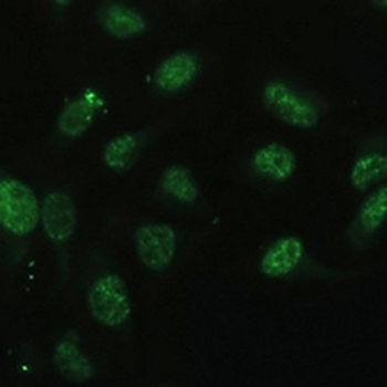 DDX50 Rabbit Polyclonal Antibody