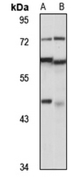 BZW2 Rabbit Polyclonal Antibody