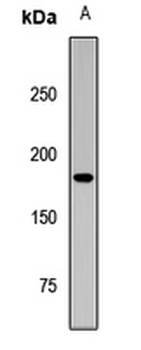 SETBP1 Rabbit Polyclonal Antibody