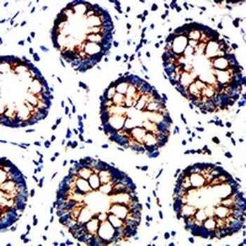 UQCRC1 Mouse Monoclonal Antibody