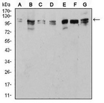 ULK2 Mouse Monoclonal Antibody
