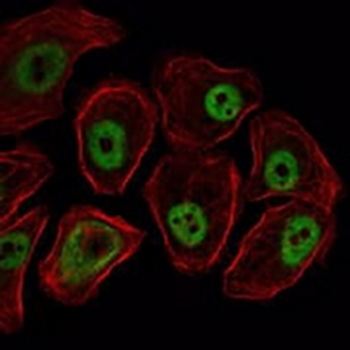 SMC1A Mouse Monoclonal Antibody