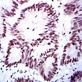 RPA1 Mouse Monoclonal Antibody
