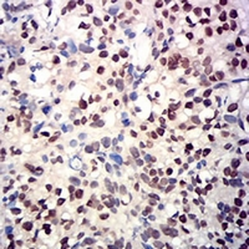 RbAp46 Mouse Monoclonal Antibody