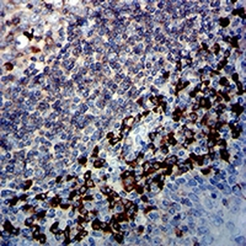 CD45 Mouse Monoclonal Antibody