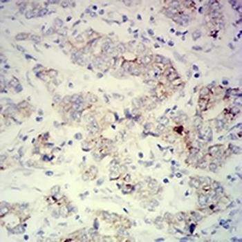 PCK2 Mouse Monoclonal Antibody