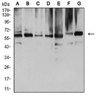 ARD1 Mouse Monoclonal Antibody
