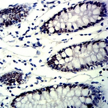 MSH6 Mouse Monoclonal Antibody