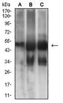 MSH6 Mouse Monoclonal Antibody