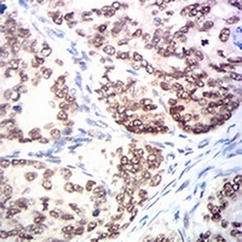 MSH2 Mouse Monoclonal Antibody