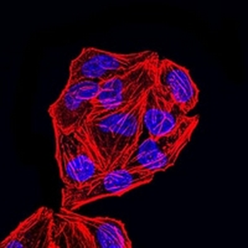 MSH2 Mouse Monoclonal Antibody