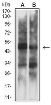 Cytokeratin 15 Mouse Monoclonal Antibody