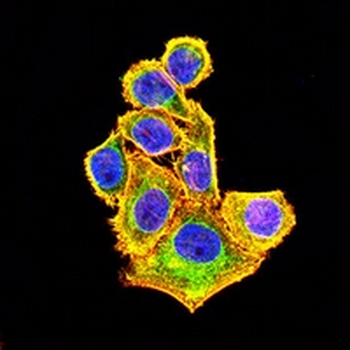 Cytokeratin 14 Mouse Monoclonal Antibody