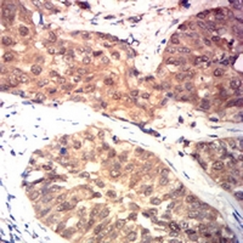 HSPA4 Mouse Monoclonal Antibody