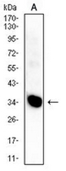 HLA-DPA1 Mouse Monoclonal Antibody