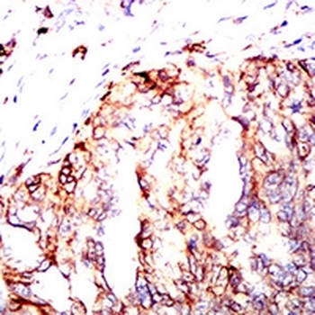 HLA-DPA1 Mouse Monoclonal Antibody