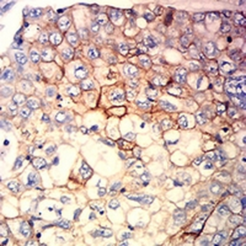 HLA-C Mouse Monoclonal Antibody