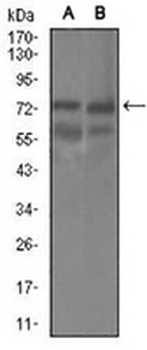 GUCY1A3 Mouse Monoclonal Antibody