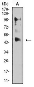 ERR alpha Mouse Monoclonal Antibody