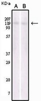 EPHB6 Mouse Monoclonal Antibody