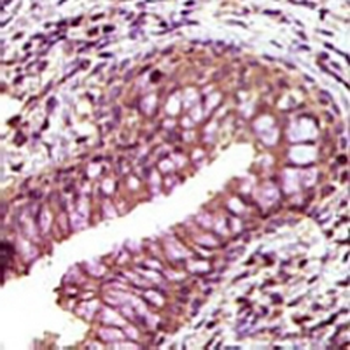 EPHB6 Mouse Monoclonal Antibody
