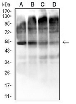 EIF2B3 Mouse Monoclonal Antibody