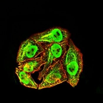 EIF2B3 Mouse Monoclonal Antibody