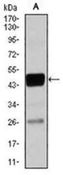 C/EBP alpha Mouse Monoclonal Antibody