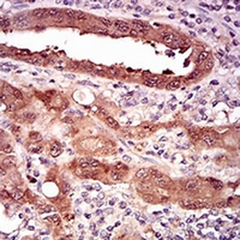 p16 INK4a Mouse Monoclonal Antibody