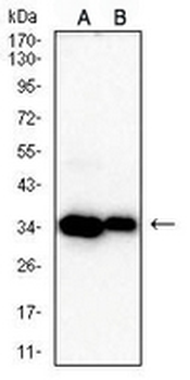 CDK4 Mouse Monoclonal Antibody