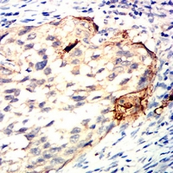 CDK4 Mouse Monoclonal Antibody