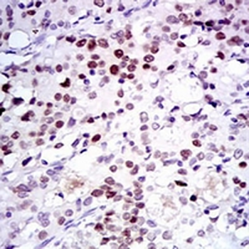 CDK2 Mouse Monoclonal Antibody