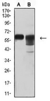 CD46 Mouse Monoclonal Antibody