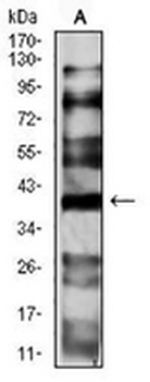 CD191 Mouse Monoclonal Antibody