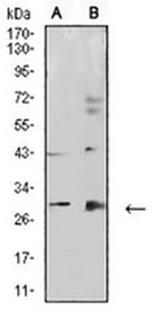 Calretinin Mouse Monoclonal Antibody