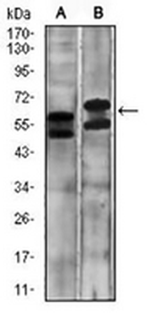 Carbonic Anhydrase 9 Mouse Monoclonal Antibody