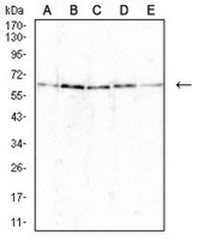 BCL6 Mouse Monoclonal Antibody