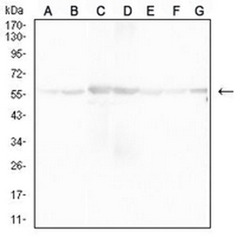 ATP5A1 Mouse Monoclonal Antibody