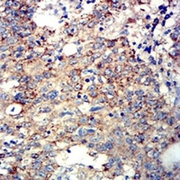 ATG3 Mouse Monoclonal Antibody
