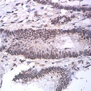 ASH2L Mouse Monoclonal Antibody