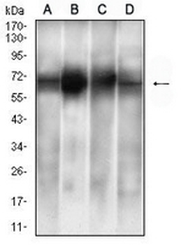 ALB Mouse Monoclonal Antibody