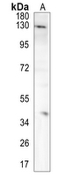 CD66e Rabbit Polyclonal Antibody