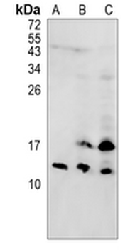 CDK2AP2 Rabbit Polyclonal Antibody
